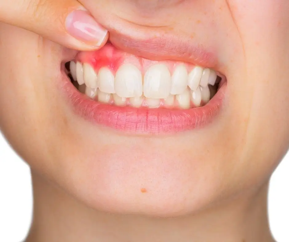woman with dental disease